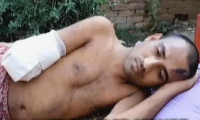 786 പച്ചകുത്തി; ഉത്തർ പ്രദേശ് സ്വദേശിയായ യുവാവിന്റെ കൈ വെട്ടിമാറ്റി 786 പച്ചകുത്തി; ഉത്തർ പ്രദേശ് സ്വദേശിയായ യുവാവിന്റെ കൈ വെട്ടിമാറ്റി