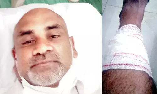 അബൂദബി പൊട്ടിത്തെറി: സാദിഖിന്‍റെ പിന്‍കാലില്‍ ചില്ല് തുളച്ചു കയറിയത് രക്ഷപ്പെട്ട് ഓടുന്നതിനിടെ