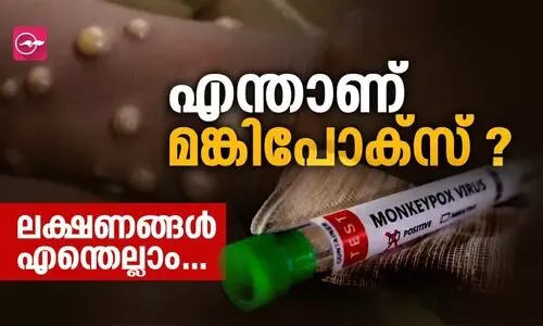 എന്താണ് മങ്കിപോക്‌സ്, ലക്ഷണങ്ങൾ ?