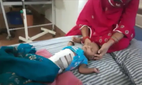 മോത്തിഹാരിയിൽ 40 ദിവസം പ്രായമുള്ള കുഞ്ഞിന്റെ വയറിനുള്ളിൽ ഭ്രൂണം