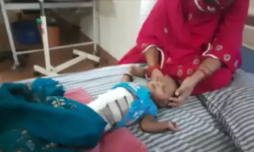 മോത്തിഹാരിയിൽ 40 ദിവസം പ്രായമുള്ള കുഞ്ഞിന്റെ വയറിനുള്ളിൽ ഭ്രൂണം