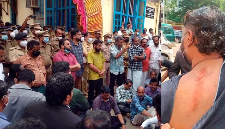 ആറ്റിങ്ങലിൽ പൊലീസ്-അഭിഭാഷക സംഘർഷം; ഉപരോധം, സി.ഐക്കെതിരെ നടപടി ആറ്റിങ്ങലിൽ പൊലീസ്-അഭിഭാഷക സംഘർഷം; ഉപരോധം, സി.ഐക്കെതിരെ നടപടി