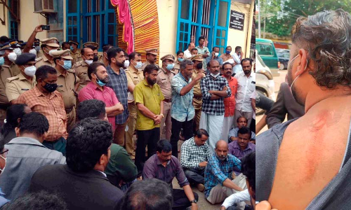 ആറ്റിങ്ങലിൽ പൊലീസ്-അഭിഭാഷക സംഘർഷം; ഉപരോധം, സി.ഐക്കെതിരെ നടപടി