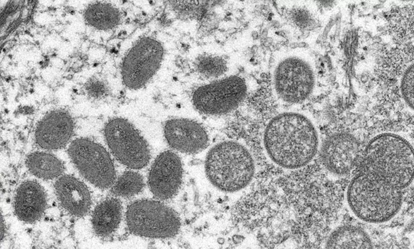 മങ്കിപോക്സ് ആഗോള മഹാമാരിക്ക് കാരണമാകില്ലെന്നാവർത്തിച്ച് ലോകാരോഗ്യ സംഘടന മങ്കിപോക്സ് ആഗോള മഹാമാരിക്ക് കാരണമാകില്ലെന്നാവർത്തിച്ച് ലോകാരോഗ്യ സംഘടന