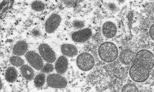 മങ്കിപോക്സ് ആഗോള മഹാമാരിക്ക് കാരണമാകില്ലെന്നാവർത്തിച്ച് ലോകാരോഗ്യ സംഘടന