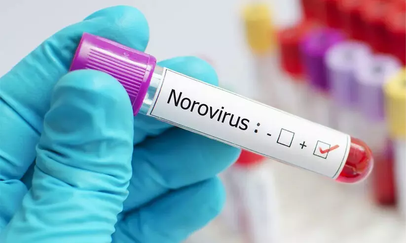 തിരുവനന്തപുരത്ത് രണ്ട് കുട്ടികളിൽ നോറോ വൈറസ് തിരുവനന്തപുരത്ത് രണ്ട് കുട്ടികളിൽ നോറോ വൈറസ്