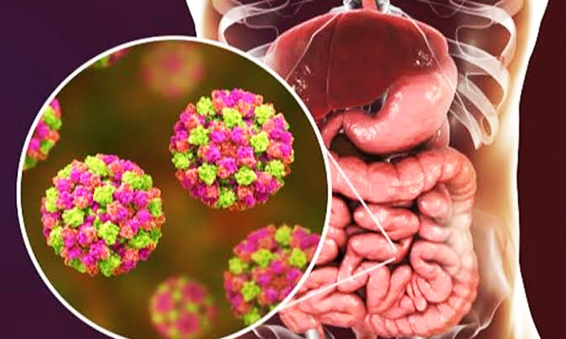 Norovirus