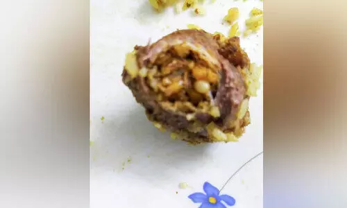 The parts including the anus of the chicken in the biryani