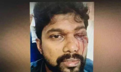 മുഖ്യമന്ത്രിക്കെതിരായ പ്രതിഷേധം: ലാത്തിച്ചാര്‍ജില്‍ യൂത്ത് കോണ്‍ഗ്രസ് നേതാവിന്റെ കണ്ണിന് ഗുരുതര പരിക്ക്