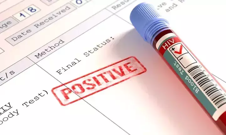 drug for AIDS drug for AIDS