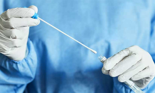 അബൂദബിയിലെ സൗജന്യ ടെന്‍റുകളില്‍ പി.സി.ആര്‍ പരിശോധനക്ക് വന്‍ തിരക്ക്