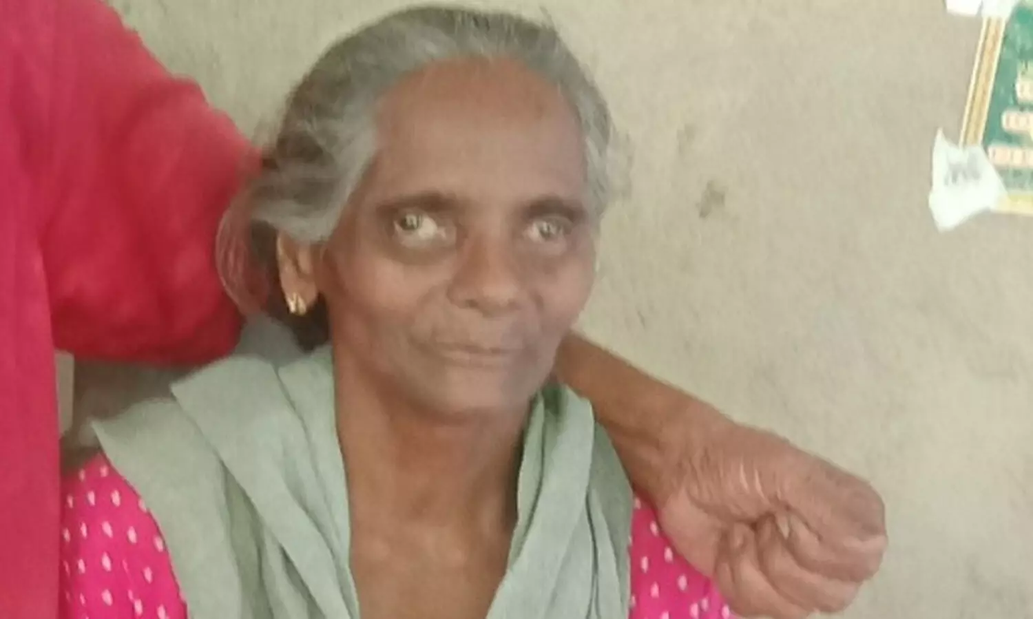 നായുടെ കടിയേറ്റിട്ടും ചികിത്സിച്ചില്ല; പേവിഷബാധയേറ്റ് വീട്ടമ്മ മരിച്ചു