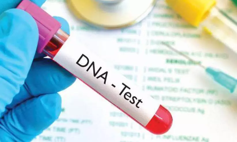 DNA testing DNA testing