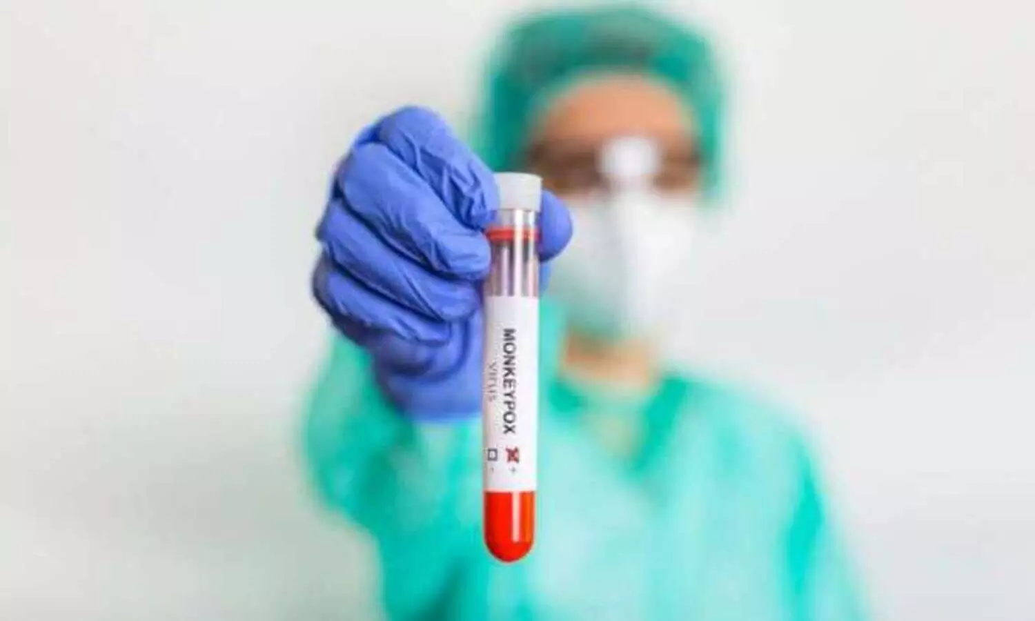 മങ്കിപോക്സിനെ മഹാമാരിയായി പ്രഖ്യാപിച്ചു