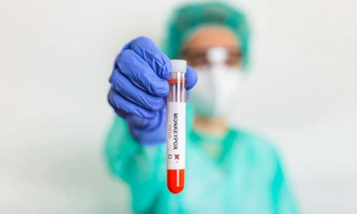 മങ്കിപോക്സിനെ മഹാമാരിയായി പ്രഖ്യാപിച്ചു