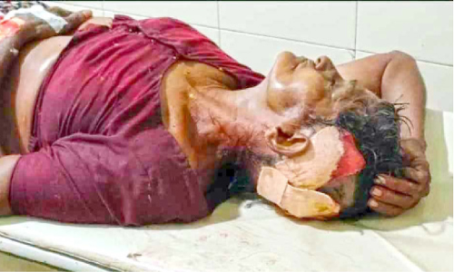 റിപ്പർ മോഡൽ അക്രമം; വയോധികയെ തലക്കടിച്ച് മാല കവർന്നു റിപ്പർ മോഡൽ അക്രമം; വയോധികയെ തലക്കടിച്ച് മാല കവർന്നു