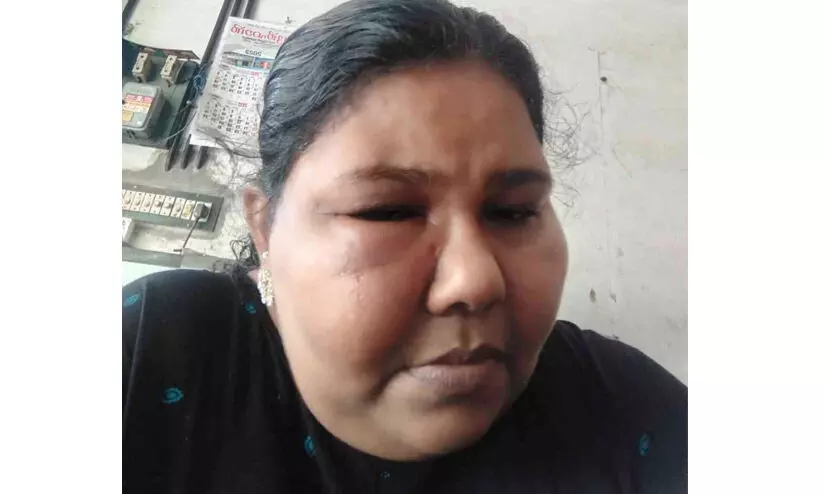 കോവിഡ് വാക്സിനെടുത്ത വീട്ടമ്മയുടെ ജീവിതം വഴിമുട്ടി