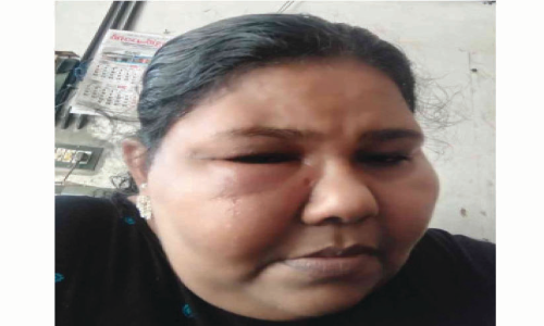 കോവിഡ് വാക്സിനെടുത്ത വീട്ടമ്മയുടെ ജീവിതം വഴിമുട്ടി