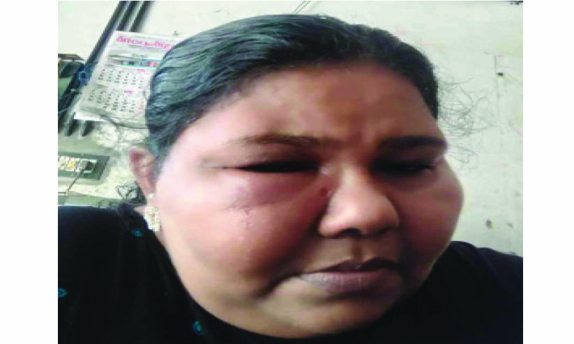 കോവിഡ് വാക്സിനെടുത്ത വീട്ടമ്മയുടെ ജീവിതം വഴിമുട്ടി