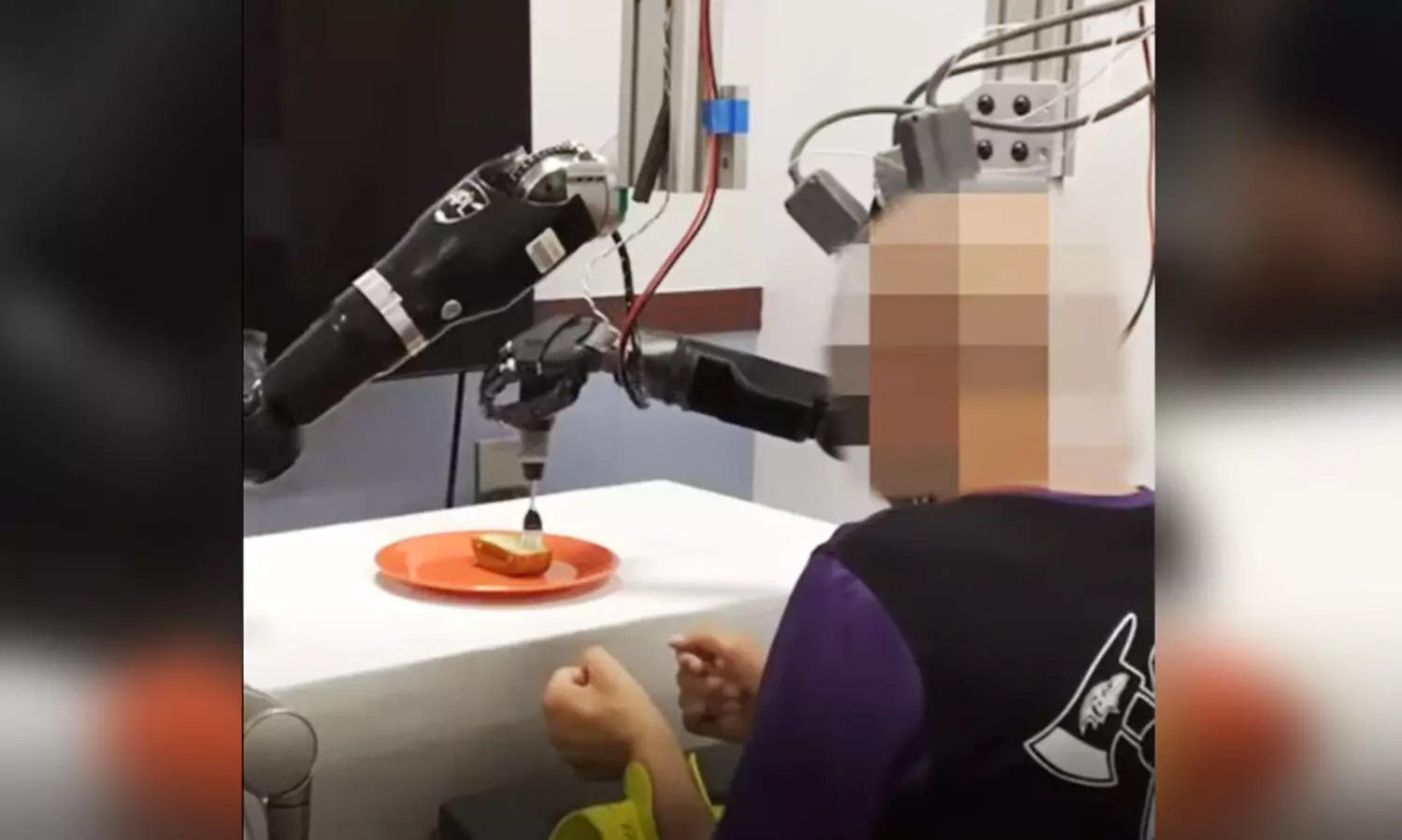 വിരൽ പോലും അനക്കാതെ 30 വർഷങ്ങൾ; ഒടുവിൽ യന്ത്രക്കൈ കൊണ്ട് അയാൾ പലഹാരം മുഴുവൻ കഴിച്ചു - VIDEO