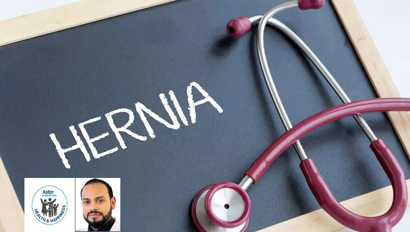 വിവിധ തരം ഹെർണിയകൾ; ലക്ഷണങ്ങളും ചികിത്സയും വിവിധ തരം ഹെർണിയകൾ; ലക്ഷണങ്ങളും ചികിത്സയും