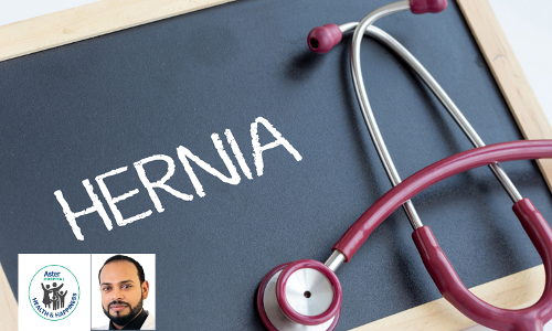 വി​വി​ധ ത​രം ഹെ​ർ​ണി​യ​ക​ൾ; ല​ക്ഷ​ണ​ങ്ങ​ളും ചി​കി​ത്സ​യും