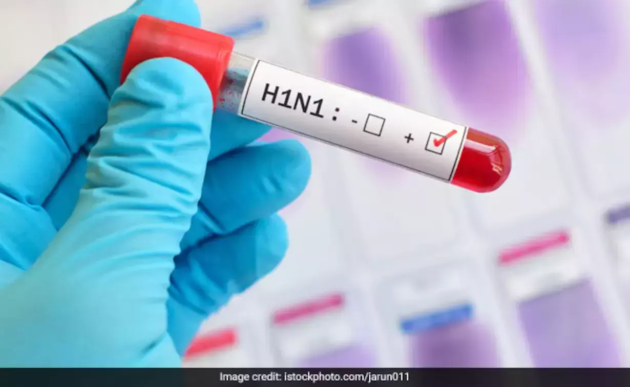 H1N1