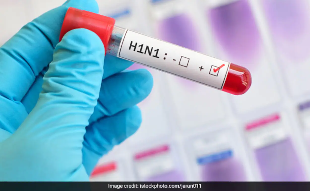 H1N1