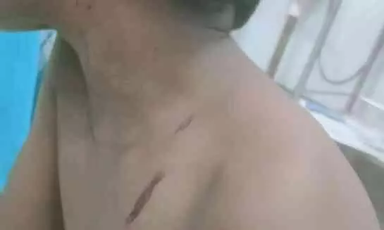 മൂന്നുവയസുകാരനെ തെരുവ് നായ കടിച്ചു; സംഭവം വീടിന് മുന്നിലിരുന്ന് കളിക്കവേ മൂന്നുവയസുകാരനെ തെരുവ് നായ കടിച്ചു; സംഭവം വീടിന് മുന്നിലിരുന്ന് കളിക്കവേ