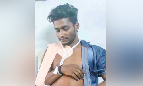 കാട്ടുപന്നി കുറുകെ ചാടി; ബൈക്ക് യാത്രികന് പരിക്ക് കാട്ടുപന്നി കുറുകെ ചാടി; ബൈക്ക് യാത്രികന് പരിക്ക്