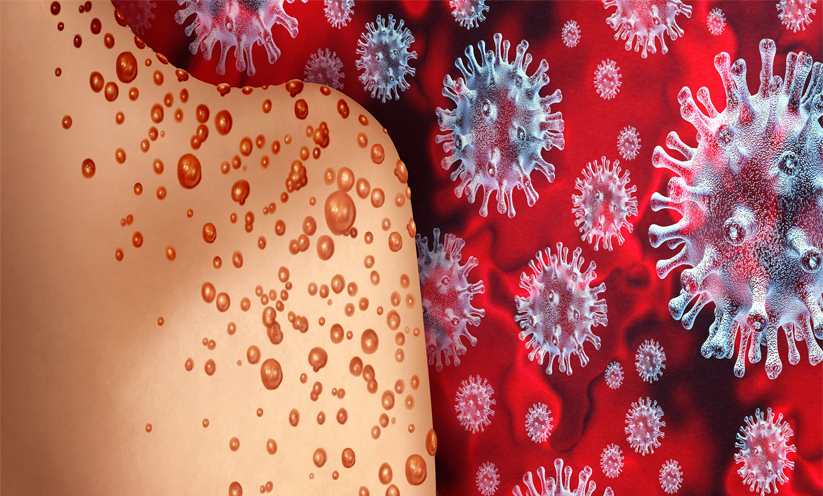 monkeypox kerala monkeypox kerala