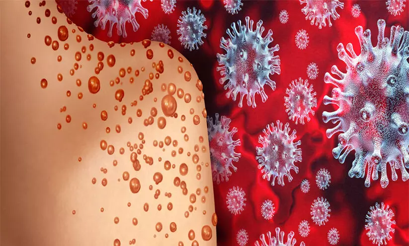 വാ​ന​ര വ​സൂ​രി​: വി​വാ​ദ​മാ​യി ജി​ല്ല മെ​ഡി​ക്ക​ൽ ഓ​ഫി​സി‍െൻറ പാ​ളി​ച്ച