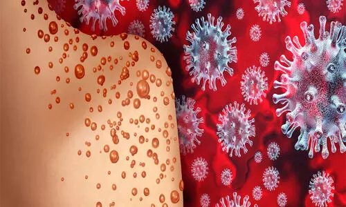 വാ​ന​ര വ​സൂ​രി​: വി​വാ​ദ​മാ​യി ജി​ല്ല മെ​ഡി​ക്ക​ൽ ഓ​ഫി​സി‍െൻറ പാ​ളി​ച്ച