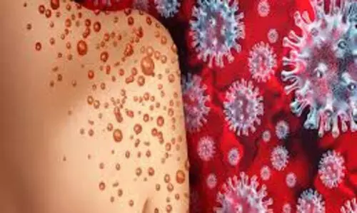 സംസ്ഥാനത്ത് ഒരാള്‍ക്ക്കൂടി മങ്കിപോക്‌സ്