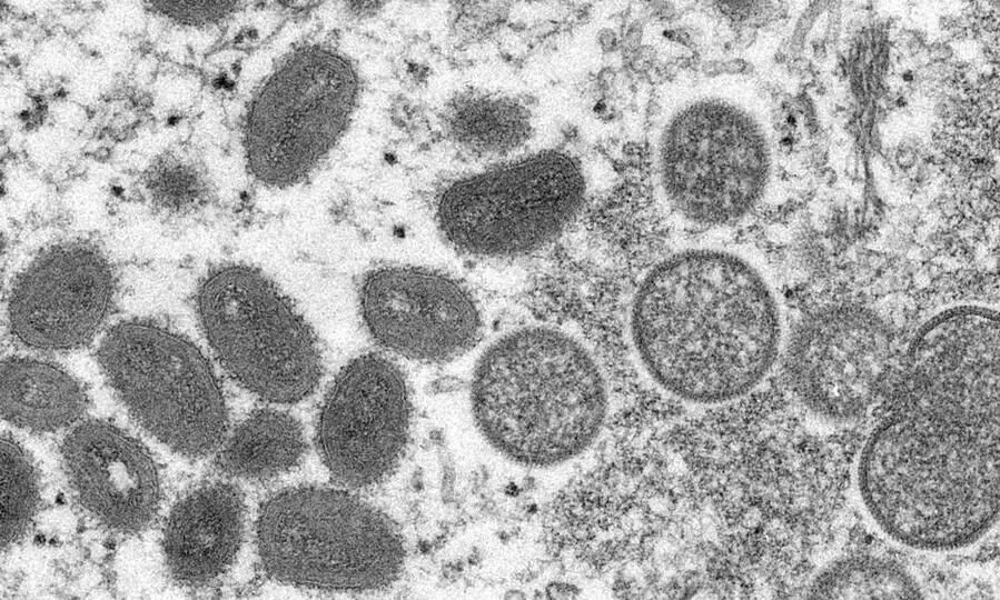 Monkey pox virus