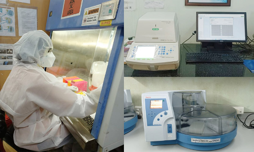 സംസ്ഥാനത്ത് മങ്കിപോക്‌സ് പരിശോധന ആരംഭിച്ചു- വീണാ ജോര്‍ജ്