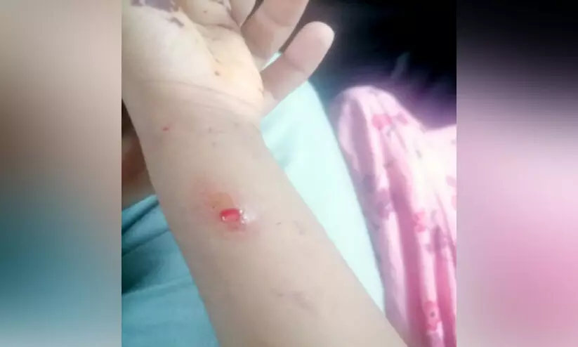 തെരുവുനായുടെ ആക്രമണത്തില് ഏഴുവയസ്സുകാരിക്കും വയോധികനും പരിക്ക് തെരുവുനായുടെ ആക്രമണത്തില് ഏഴുവയസ്സുകാരിക്കും വയോധികനും പരിക്ക്