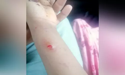 തെരുവുനായുടെ ആക്രമണത്തില്‍ ഏഴുവയസ്സുകാരിക്കും വയോധികനും പരിക്ക്