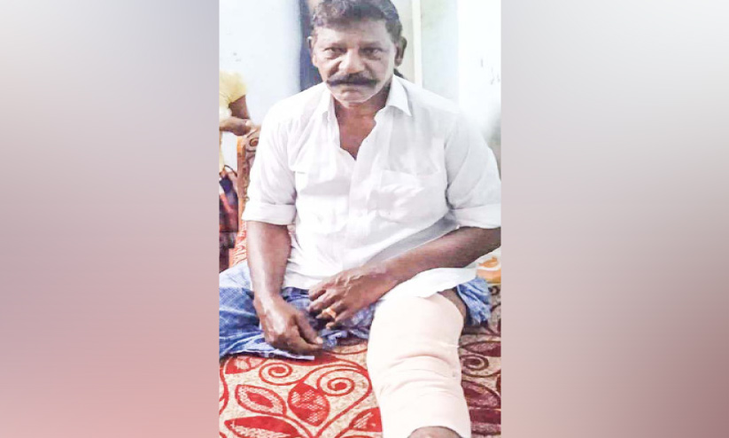 നായ്ക്കൂട്ടം സ്കൂട്ടറിന് മുന്നിൽ ചാടി; കുട്ടിയുൾപ്പെടെ മൂന്നുപേർക്ക് പരിക്ക് നായ്ക്കൂട്ടം സ്കൂട്ടറിന് മുന്നിൽ ചാടി; കുട്ടിയുൾപ്പെടെ മൂന്നുപേർക്ക് പരിക്ക്