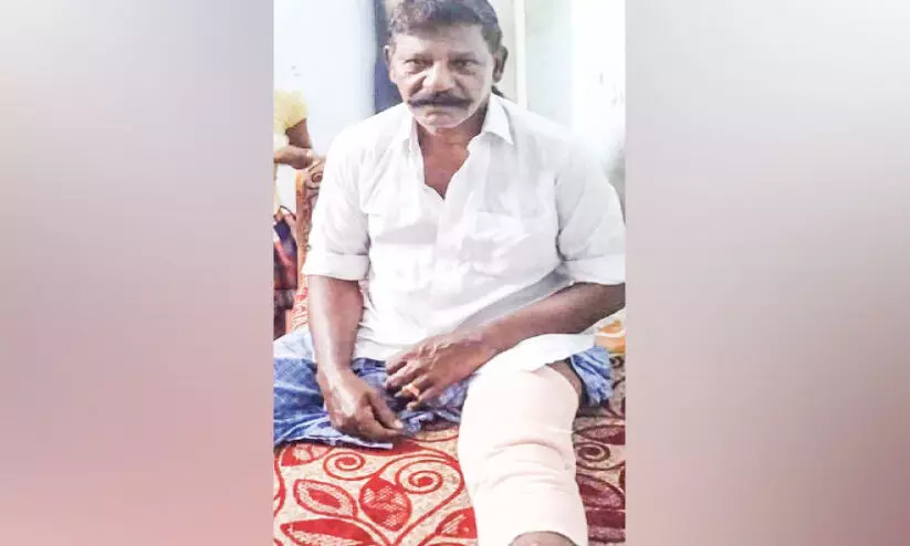 നായ്ക്കൂട്ടം സ്കൂട്ടറിന് മുന്നിൽ ചാടി; കുട്ടിയുൾപ്പെടെ മൂന്നുപേർക്ക് പരിക്ക് നായ്ക്കൂട്ടം സ്കൂട്ടറിന് മുന്നിൽ ചാടി; കുട്ടിയുൾപ്പെടെ മൂന്നുപേർക്ക് പരിക്ക്