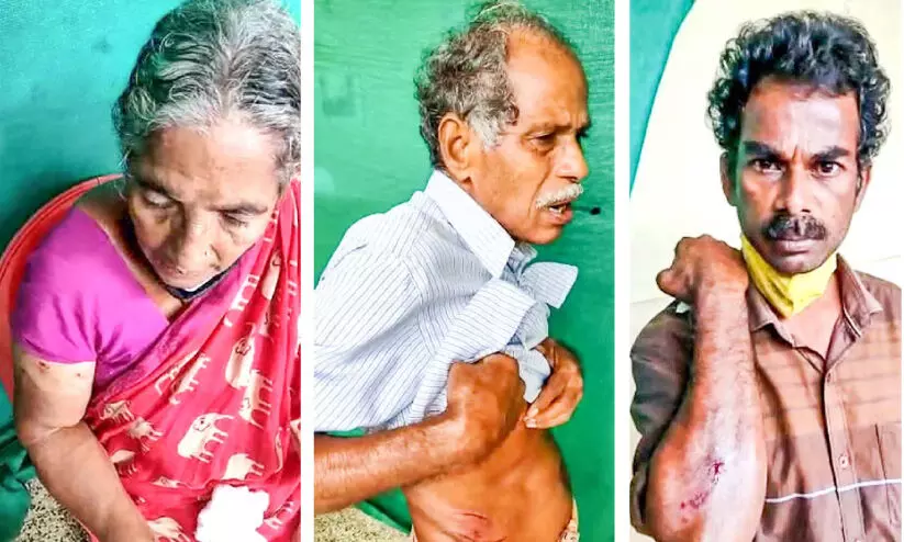 പേപിടിച്ച നായുടെ ആക്രമണത്തിൽ വൈക്കത്ത് അഞ്ചുപേർക്ക് പരിക്ക് പേപിടിച്ച നായുടെ ആക്രമണത്തിൽ വൈക്കത്ത് അഞ്ചുപേർക്ക് പരിക്ക്