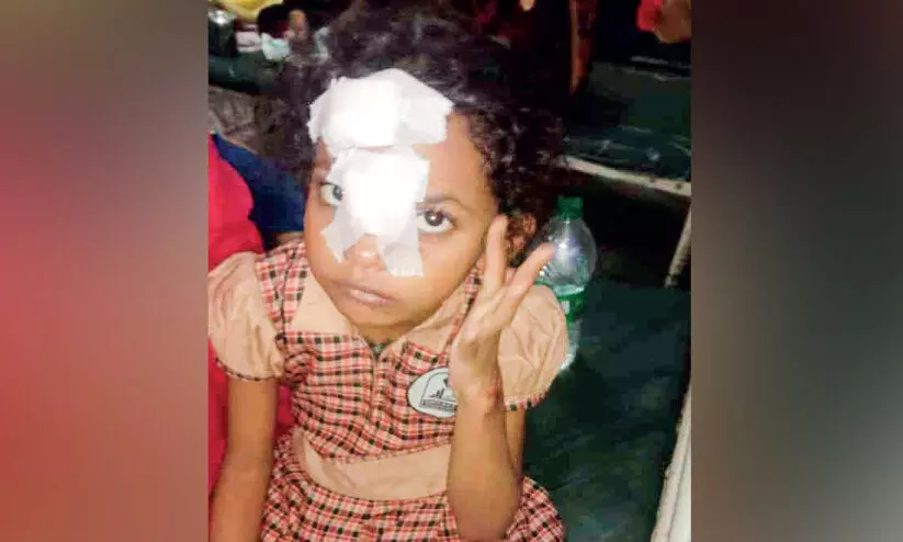 തെരുവുനായുടെ ആക്രമണത്തിൽ കുട്ടിയടക്കം മൂന്നുപേർക്ക് പരിക്ക്