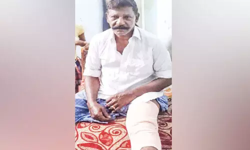 നായ്ക്കൂട്ടം സ്കൂട്ടറിന് മുന്നിൽ ചാടി; കുട്ടിയുൾപ്പെടെ മൂന്നുപേർക്ക് പരിക്ക്