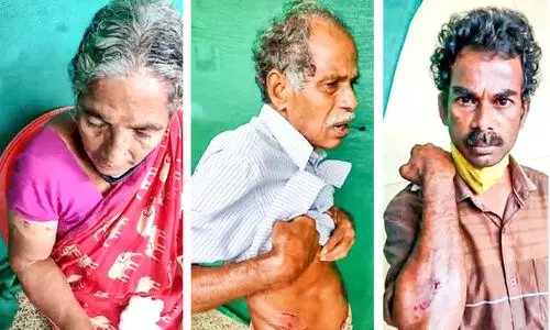 പേ​പി​ടി​ച്ച നാ​യു​ടെ ആ​ക്ര​മ​ണ​ത്തി​ൽ വൈ​ക്ക​ത്ത്​ അ​ഞ്ചു​പേ​ർ​ക്ക്​ പ​രി​ക്ക്