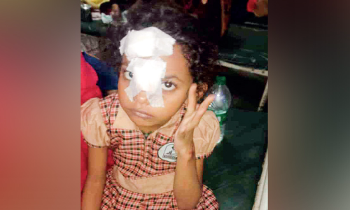 തെരുവുനായുടെ ആക്രമണത്തിൽ കുട്ടിയടക്കം മൂന്നുപേർക്ക് പരിക്ക്