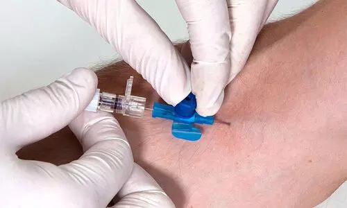 trip needle broken trip needle broken