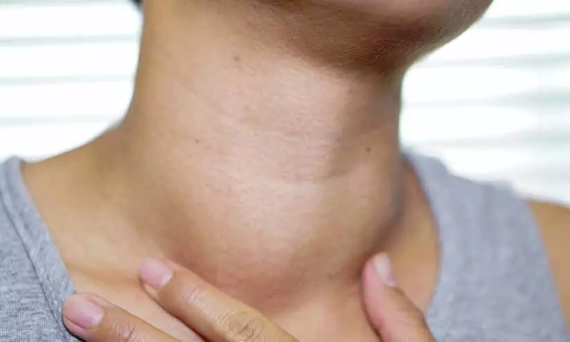 കഴുത്തിലെ മുഴകള് നിസ്സാരമാക്കേണ്ട കഴുത്തിലെ മുഴകള് നിസ്സാരമാക്കേണ്ട