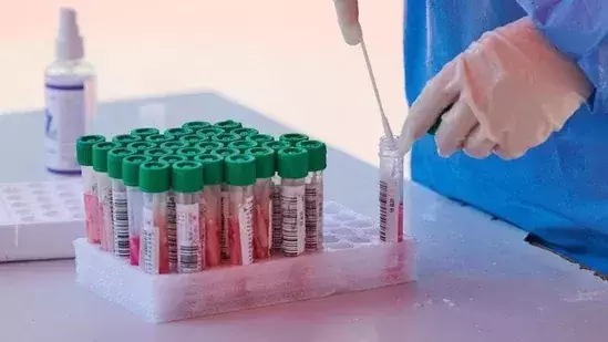 യു.എസിൽ ഒരേ സമയം ഒരാൾക്ക് ​മങ്കിപോക്സും കോവിഡും ബാധിച്ചു; അപൂർവമെന്ന് ഡോക്ടർമാർ