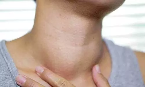 ക​ഴു​ത്തി​ലെ മു​ഴ​ക​ള്‍ നി​സ്സാ​ര​മാക്കേ​ണ്ട