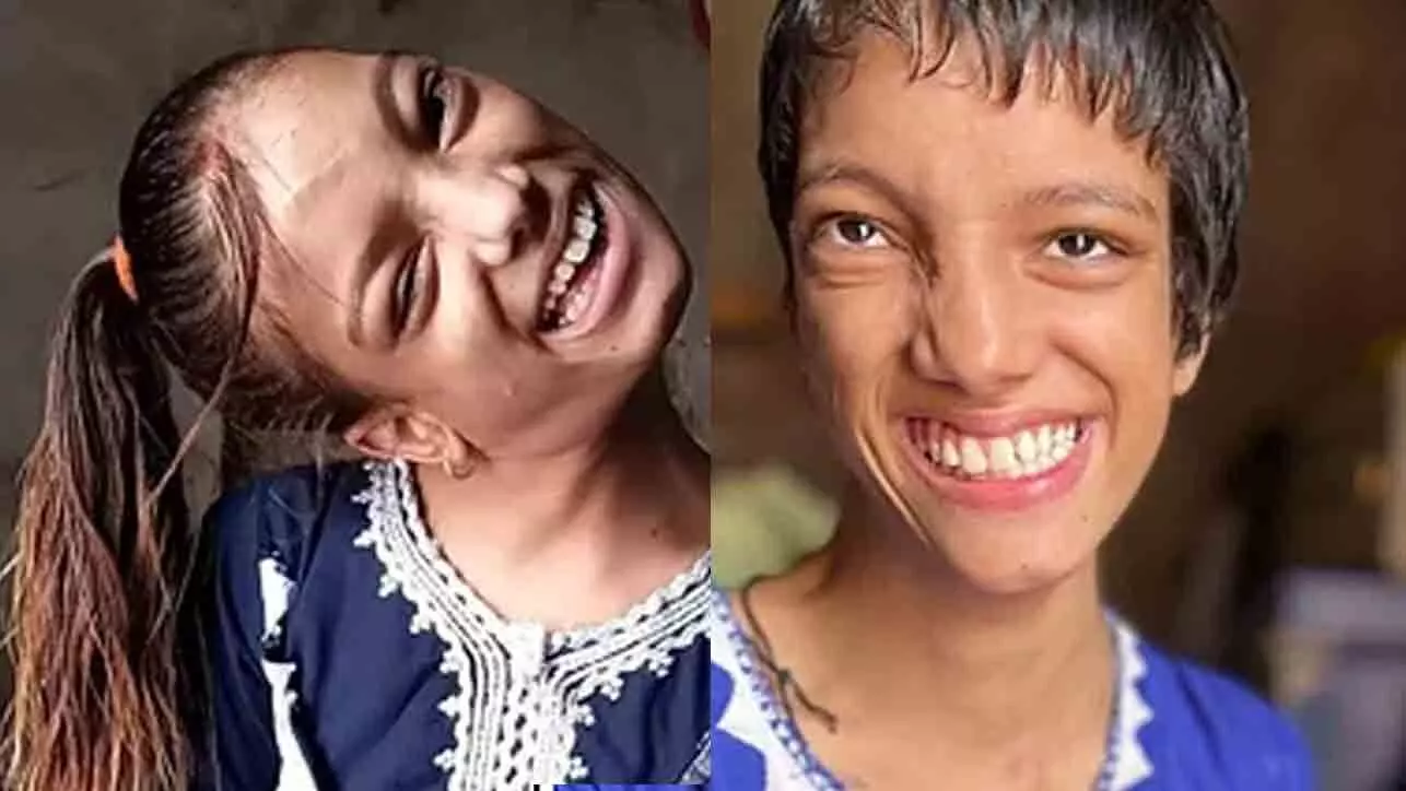 നന്ദി ഇന്ത്യ! 10ാം മാസം വീണ് കഴുത്തൊടിഞ്ഞ പാകിസ്താൻ പെൺകുട്ടി 12 വർഷത്തിന് ശേഷം ഡൽഹിയിലെ ചികിത്സയിൽ സുഖംപ്രാപിച്ചു നന്ദി ഇന്ത്യ! 10ാം മാസം വീണ് കഴുത്തൊടിഞ്ഞ പാകിസ്താൻ പെൺകുട്ടി 12 വർഷത്തിന് ശേഷം ഡൽഹിയിലെ ചികിത്സയിൽ സുഖംപ്രാപിച്ചു